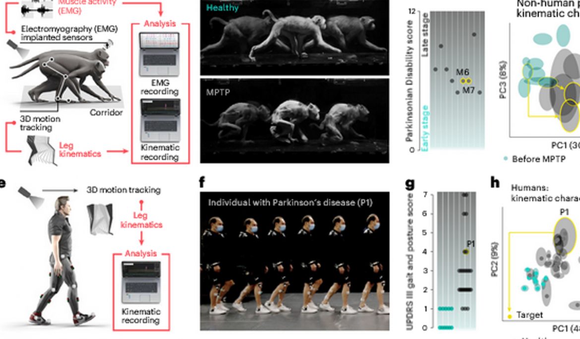 Crean una neuroprótesis contra el Párkinson